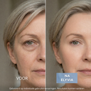 ELYVIA - The 90 Day Skin Reset