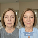 ELYVIA - The 90 Day Skin Reset