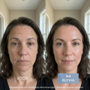 ELYVIA - The 90 Day Skin Reset