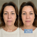 ELYVIA - The 90 Day Skin Reset