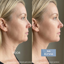 ELYVIA - The 90 Day Skin Reset