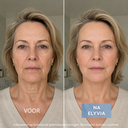 ELYVIA - The 90 Day Skin Reset