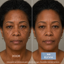 ELYVIA - The 90 Day Skin Reset