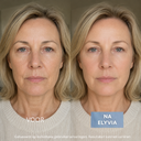 ELYVIA - The 90 Day Skin Reset
