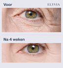 ELYVIA Skin Renewal Patches™