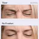 ELYVIA Skin Renewal Patches™