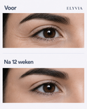 ELYVIA Skin Renewal Patches™