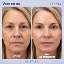 ELYVIA Skin Renewal Mask™