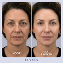 ELYVIA Skin Renewal Mask™