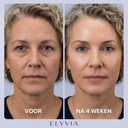 ELYVIA Skin Renewal Mask™