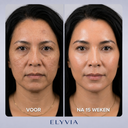 ELYVIA Skin Renewal Mask™