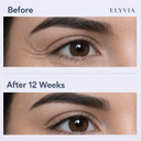 ELYVIA Skin Renewal Patches™