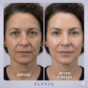 ELYVIA Skin Renewal Mask™