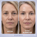 ELYVIA Skin Renewal Mask™