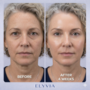 ELYVIA Skin Renewal Mask™
