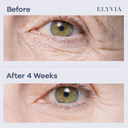 ELYVIA Skin Renewal Patches™