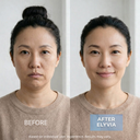 ELYVIA Complete Skin System™