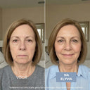 ELYVIA - The 90 Day Skin Reset