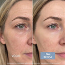 ELYVIA - The 90 Day Skin Reset