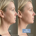 ELYVIA - The 90 Day Skin Reset